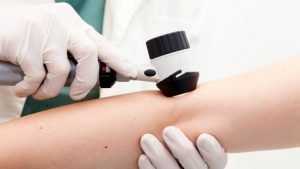Ce trebuie sa stim despre dermatoscopie?